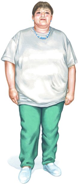 Percutaneous Coronary Intervention