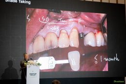 Dentium Implant Excellence Forum 2025