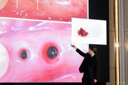 Dentium Implant Excellence Forum 2025