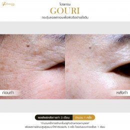 Gouri Collagen PCL 21% สร้างคอลลาเจนอย่างยั่งยืน เปลี่ยนผิวเก่าเป็นผิวใหม่