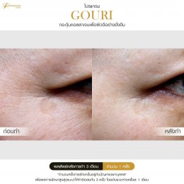 Gouri Collagen PCL 21% สร้างคอลลาเจนอย่างยั่งยืน เปลี่ยนผิวเก่าเป็นผิวใหม่