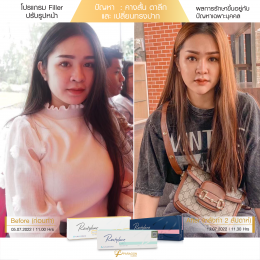 Review Filler ปรับรูปหน้า