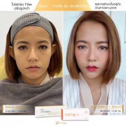 Review Filler ปรับรูปหน้า