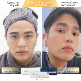 Review Filler ปรับรูปหน้า