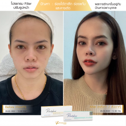 Review Filler ปรับรูปหน้า