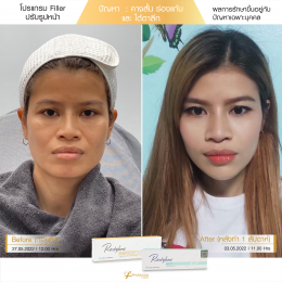 Review Filler ปรับรูปหน้า