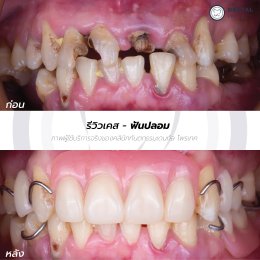 รีวิวรวม