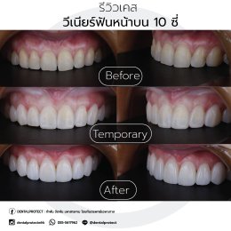 รีวิวรวม