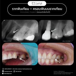 รีวิวรวม