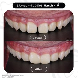 รีวิวรวม