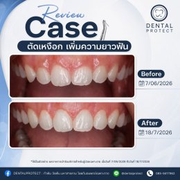 รีวิวรวม