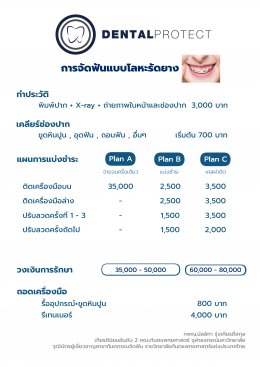 ค่าใช้จ่าย