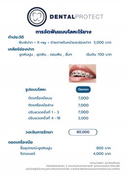 ค่าใช้จ่าย