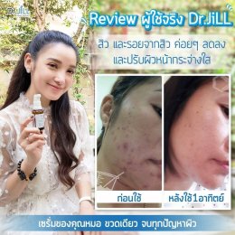 Dr JiLL รีวิว ผลการใช้จริง *สงวนสิทธิ์การนำภาพไปใช้โดยไม่ได้รับอนุญาต