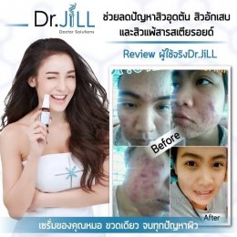 Dr JiLL รีวิว ผลการใช้จริง *สงวนสิทธิ์การนำภาพไปใช้โดยไม่ได้รับอนุญาต