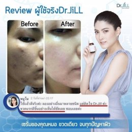 Dr JiLL รีวิว ผลการใช้จริง *สงวนสิทธิ์การนำภาพไปใช้โดยไม่ได้รับอนุญาต