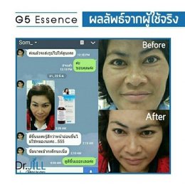 Dr JiLL รีวิว ผลการใช้จริง *สงวนสิทธิ์การนำภาพไปใช้โดยไม่ได้รับอนุญาต