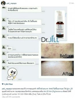 Dr JiLL รีวิว ผลการใช้จริง *สงวนสิทธิ์การนำภาพไปใช้โดยไม่ได้รับอนุญาต