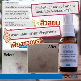 Dr JiLL รีวิว ผลการใช้จริง *สงวนสิทธิ์การนำภาพไปใช้โดยไม่ได้รับอนุญาต