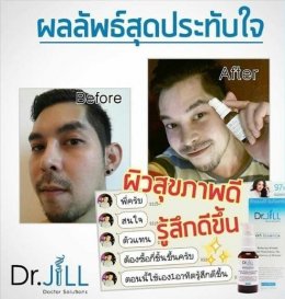 ผู้ชาย ใช้เซรั่ม Dr.JILL ดีไหม ?