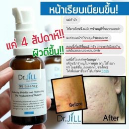 Dr JiLL รีวิว ผลการใช้จริง *สงวนสิทธิ์การนำภาพไปใช้โดยไม่ได้รับอนุญาต