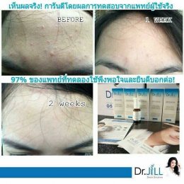 Dr JiLL รีวิว ผลการใช้จริง *สงวนสิทธิ์การนำภาพไปใช้โดยไม่ได้รับอนุญาต