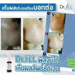 Dr JiLL รีวิว ผลการใช้จริง *สงวนสิทธิ์การนำภาพไปใช้โดยไม่ได้รับอนุญาต