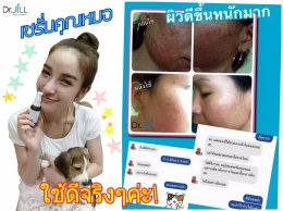 Dr JiLL รีวิว ผลการใช้จริง *สงวนสิทธิ์การนำภาพไปใช้โดยไม่ได้รับอนุญาต