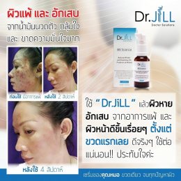 Dr JiLL รีวิว ผลการใช้จริง *สงวนสิทธิ์การนำภาพไปใช้โดยไม่ได้รับอนุญาต