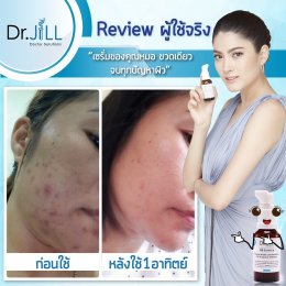 Dr JiLL รีวิว ผลการใช้จริง *สงวนสิทธิ์การนำภาพไปใช้โดยไม่ได้รับอนุญาต