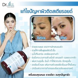 Dr JiLL รีวิว ผลการใช้จริง *สงวนสิทธิ์การนำภาพไปใช้โดยไม่ได้รับอนุญาต