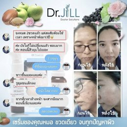 Dr JiLL รีวิว ผลการใช้จริง *สงวนสิทธิ์การนำภาพไปใช้โดยไม่ได้รับอนุญาต