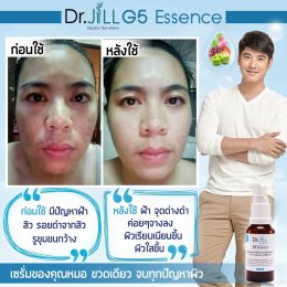 Dr JiLL รีวิว ผลการใช้จริง *สงวนสิทธิ์การนำภาพไปใช้โดยไม่ได้รับอนุญาต