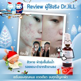 Dr JiLL รีวิว ผลการใช้จริง *สงวนสิทธิ์การนำภาพไปใช้โดยไม่ได้รับอนุญาต