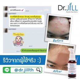 Dr JiLL รีวิว ผลการใช้จริง *สงวนสิทธิ์การนำภาพไปใช้โดยไม่ได้รับอนุญาต