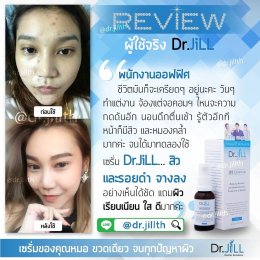 Dr JiLL รีวิว ผลการใช้จริง *สงวนสิทธิ์การนำภาพไปใช้โดยไม่ได้รับอนุญาต