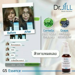 Dr JiLL รีวิว ผลการใช้จริง *สงวนสิทธิ์การนำภาพไปใช้โดยไม่ได้รับอนุญาต