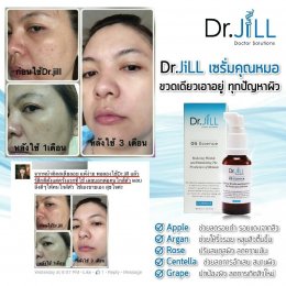 Dr JiLL รีวิว ผลการใช้จริง *สงวนสิทธิ์การนำภาพไปใช้โดยไม่ได้รับอนุญาต