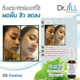 Dr JiLL รีวิว ผลการใช้จริง *สงวนสิทธิ์การนำภาพไปใช้โดยไม่ได้รับอนุญาต