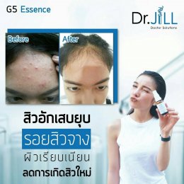 Dr JiLL รีวิว ผลการใช้จริง *สงวนสิทธิ์การนำภาพไปใช้โดยไม่ได้รับอนุญาต