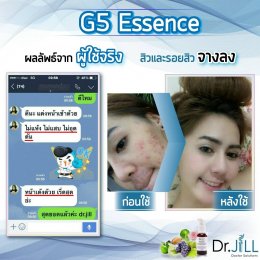 Dr JiLL รีวิว ผลการใช้จริง *สงวนสิทธิ์การนำภาพไปใช้โดยไม่ได้รับอนุญาต