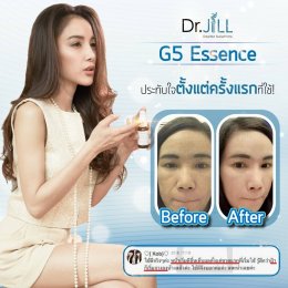 Dr JiLL รีวิว ผลการใช้จริง *สงวนสิทธิ์การนำภาพไปใช้โดยไม่ได้รับอนุญาต