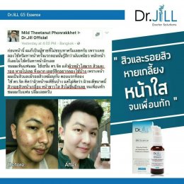 ผู้ชาย ใช้เซรั่ม Dr.JILL ดีไหม ?