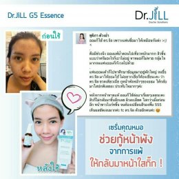 Dr JiLL รีวิว ผลการใช้จริง *สงวนสิทธิ์การนำภาพไปใช้โดยไม่ได้รับอนุญาต