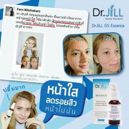 Dr JiLL รีวิว ผลการใช้จริง *สงวนสิทธิ์การนำภาพไปใช้โดยไม่ได้รับอนุญาต