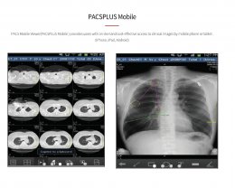Picture archiving and communication system (PACS)