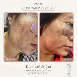 อโรเวล่า