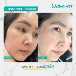 แอมพลูเซรั่ม - เซราไบร์ทครีม