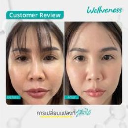 แอมพลูเซรั่ม - เซราไบร์ทครีม