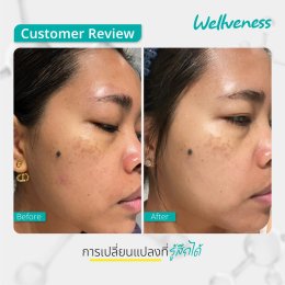 แอมพลูเซรั่ม - เซราไบร์ทครีม